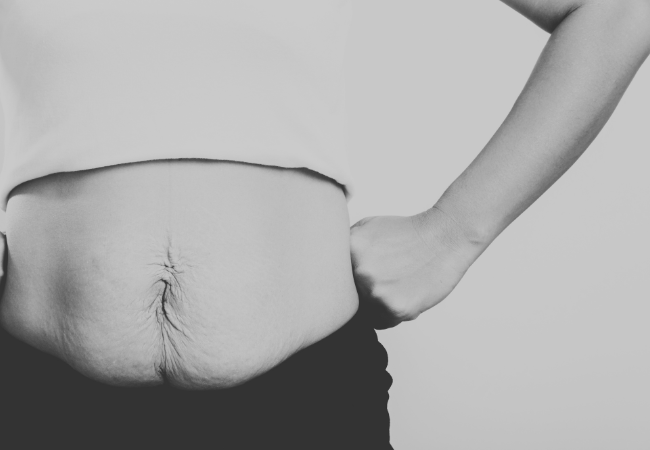 Diastase herstel onder begeleiding van Personal Trainer in Amsterdam